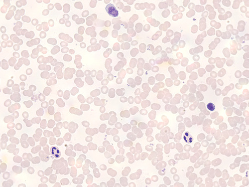PERIPHERAL BLOOD-HUMAN F (SM) GS NORMAL