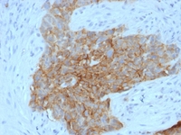 Anti-GLUT1 Mouse Monoclonal Antibody [clone: GLUT1/2475]