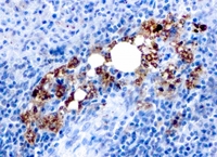 Anti-Tartrate Resistant Acid Phosphatase Mouse Recombinant Antibody [clone: rACP5/1070]