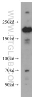 Anti-XPG Rabbit Polyclonal Antibody
