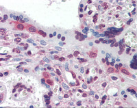 Anti-ETV4 Mouse Monoclonal Antibody [clone: [1A2G3]]