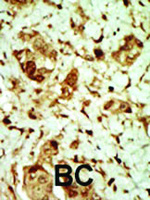 Anti-PRKAG3 Rabbit Polyclonal Antibody