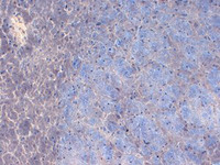 Anti-SCN2A Mouse Monoclonal Antibody [clone: S69-3]