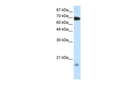 Anti-TRIM32 Rabbit Polyclonal Antibody