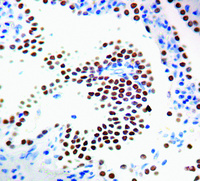 Anti-TTF1 Mouse Monoclonal Antibody [clone: 8G7G3/1]