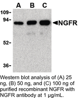 Anti-NGFR Rabbit Polyclonal Antibody
