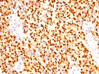 Anti-Myogenin Mouse Monoclonal Antibody [clone: SPM144]