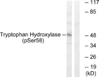 Anti-Tryptophan Hydroxylase Rabbit Polyclonal Antibody