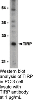 Anti-TIRP Rabbit Polyclonal Antibody