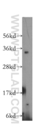 Anti-PSMD14 Rabbit Polyclonal Antibody