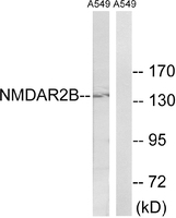 Anti-NMDAR2B Rabbit Polyclonal Antibody