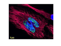 Anti-AKT1 Mouse Monoclonal Antibody (DyLight® 488) [clone: 18F3.H11]