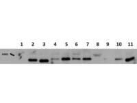 Anti-AKT1 Mouse Monoclonal Antibody [Clone: 14E5.A2.B2.H9]