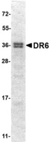 Mouse Recombinant Dr6 Cytoplasmic Domain (from E. coli)