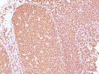 Anti-CD45RB Mouse Monoclonal Antibody [clone: PD7/26]