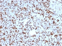 Anti-SOX9 Mouse Monoclonal Antibody [clone: SOX9/2398]