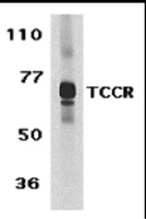 Anti-IL27RA Rabbit Polyclonal Antibody