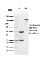 Anti-BMP15 Mouse Monoclonal Antibody [clone: BMP15/4263]