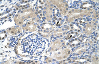 Anti-NXF1 Rabbit Polyclonal Antibody