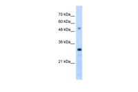 Anti-PSME3 Rabbit Polyclonal Antibody