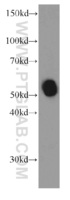Anti-AMY2A Mouse Monoclonal Antibody [clone: 2F1G8]