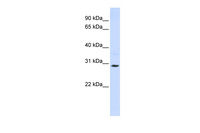 Anti-SLC25A20 Rabbit Polyclonal Antibody