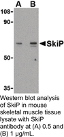 Anti-SKIP Rabbit Polyclonal Antibody