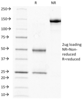 Anti-HCG beta Mouse Monoclonal Antibody [clone: HCGb/211]