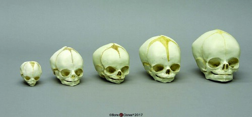 BoneClones® Fetal Skull Set