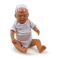 Shaken Baby Syndrome Model