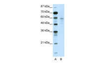 Anti-DMAP1 Rabbit Polyclonal Antibody