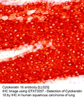 Anti-CK16 Mouse Monoclonal Antibody [clone: LL025]