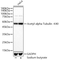 Anti-Detyrosinated alpha Tubulin (acetyl Lys40) Rabbit Polyclonal Antibody