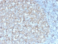 Anti-TAPA1 Mouse Recombinant Antibody [clone: r1.3.3.22]