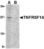 Anti-TNFRSF14 Rabbit Polyclonal Antibody