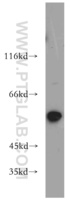 Anti-SLC16A2 Rabbit Polyclonal Antibody