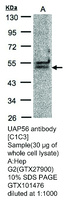 Anti-VEGF Rabbit Polyclonal Antibody