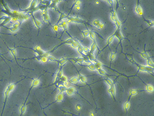 ICORTHUMAN IPSC-DERIVED CORTICAL NEURONS