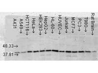 Anti-MAPK14 Mouse Monoclonal Antibody [clone: 9F12]