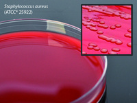 Blood Agar Plate, 5% Sheep Blood in Tryptic Soy Agar (TSA) Base, 15 × 100 mm plate, Hardy Diagnostics
