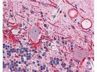 Anti-AKT1 Mouse Monoclonal Antibody (DyLight® 549) [clone: 18F3.H11]
