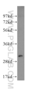 Anti-NQO1 Rabbit Polyclonal Antibody