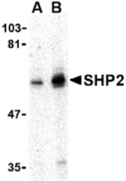 Anti-PTPN11 Rabbit Polyclonal Antibody