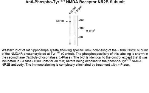 NMDA (phospho Tyr1336) Antibody