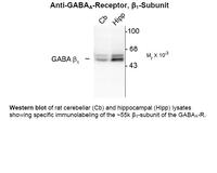 Anti-GABRB1 Rabbit Polyclonal Antibody