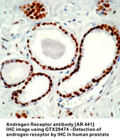 Anti-AR Mouse Monoclonal Antibody [clone: AR 441]