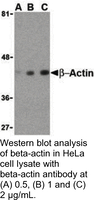 Anti-ACTB Rabbit Polyclonal Antibody