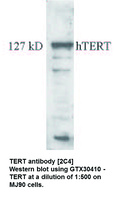 Anti-TERT Mouse Monoclonal Antibody [clone: 2C4]