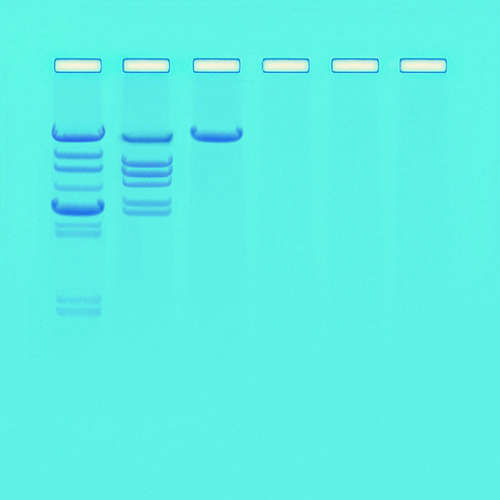 KT ANAL OF RESTRICTION ENZYME CLEVAGE