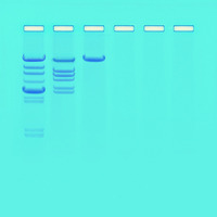 Analysis Of Restriction Enzyme Clevage Patterns Of DNA Lab Activity Kit